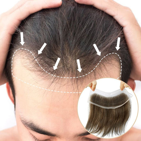Clearance | Lace Hair Patch | Covering Receding Hairline In 20 color