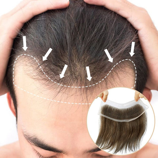 Lace Hair Patch | Covering Receding Hairline